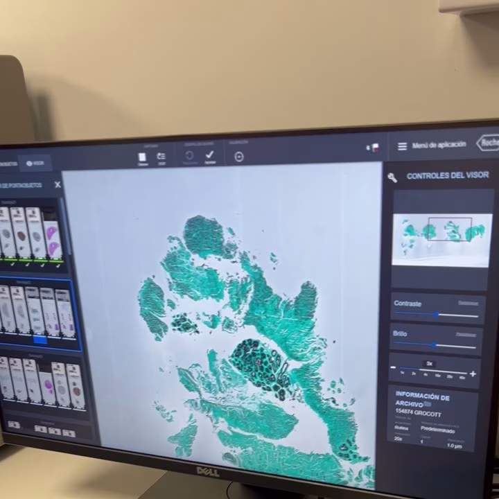 Muestra digital
